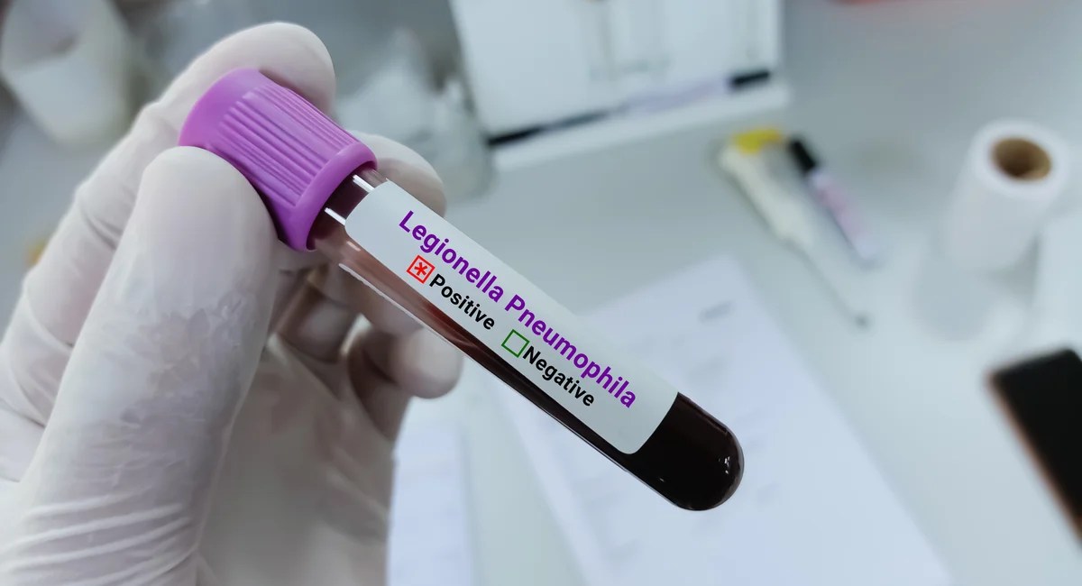 NYC Legionella Inspections: What You Need to Know (2026)